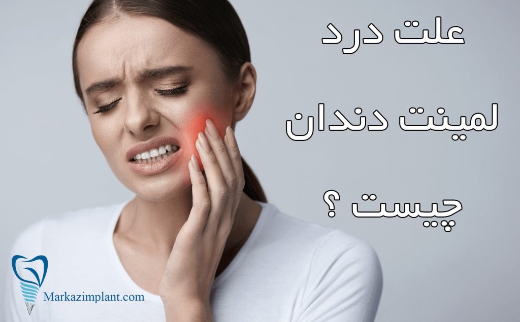 علت درد لمینت دندان چیست ؟ 