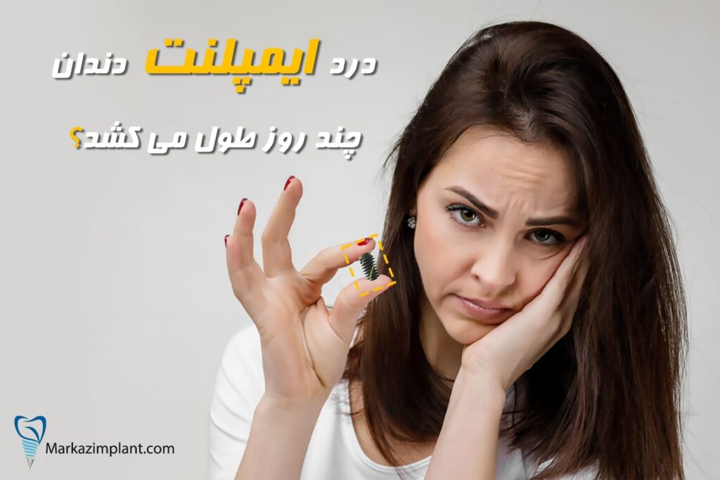 درد ایمپلنت دندان چند روز طول میکشد