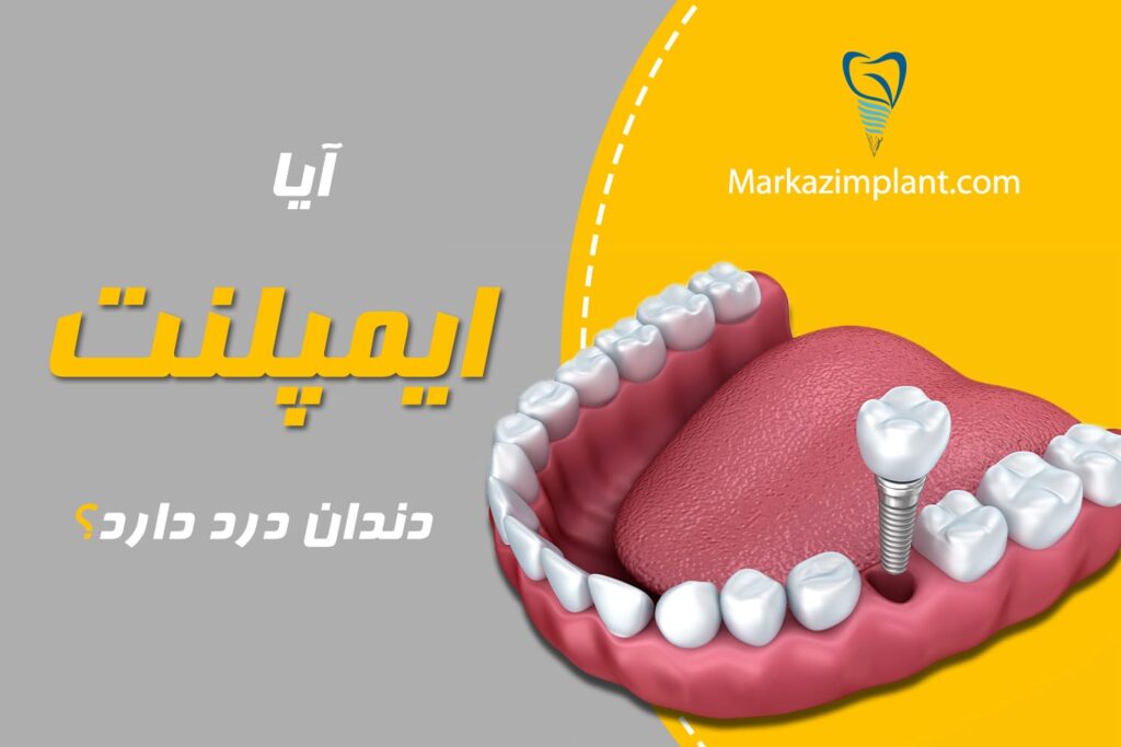 آیا ایمپلنت دندان درد دارد؟