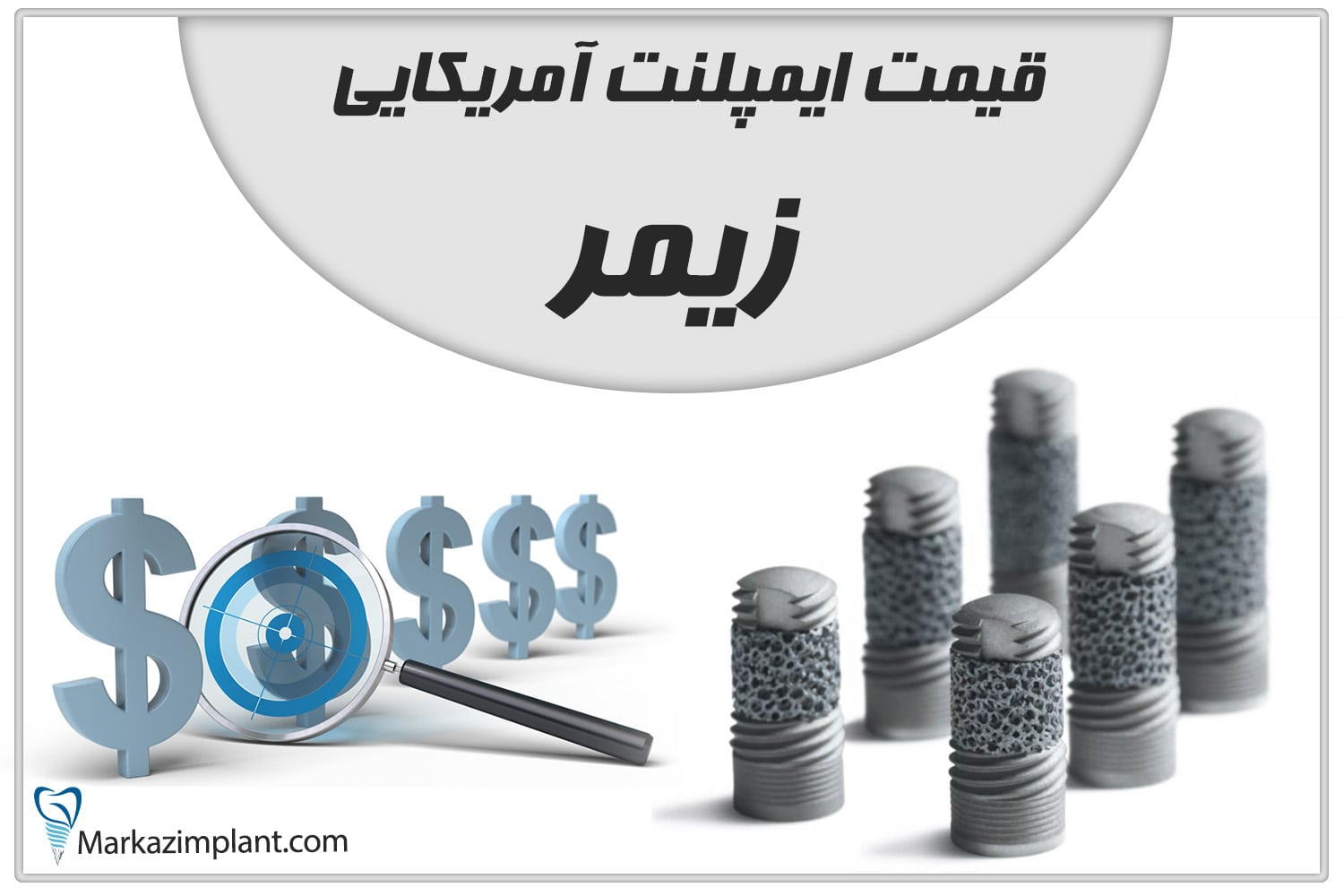 قیمت ایمپلنت زیمر آمریکا