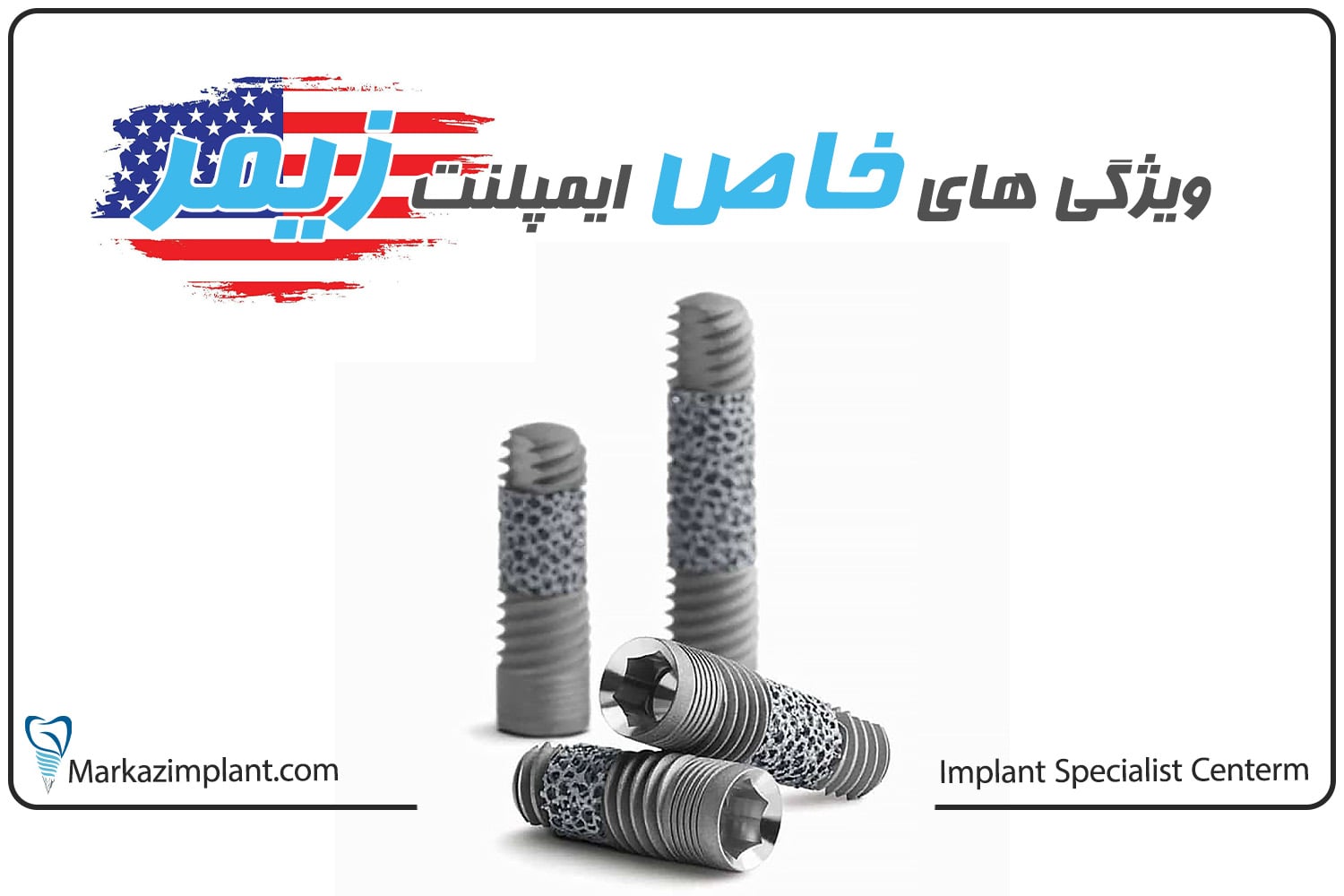 ویژگیهای خاص ایمپلنت زیمر