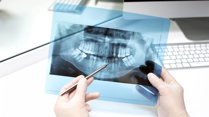 رادیولوژی دندان