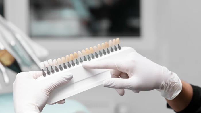 ایمپلنت دندان