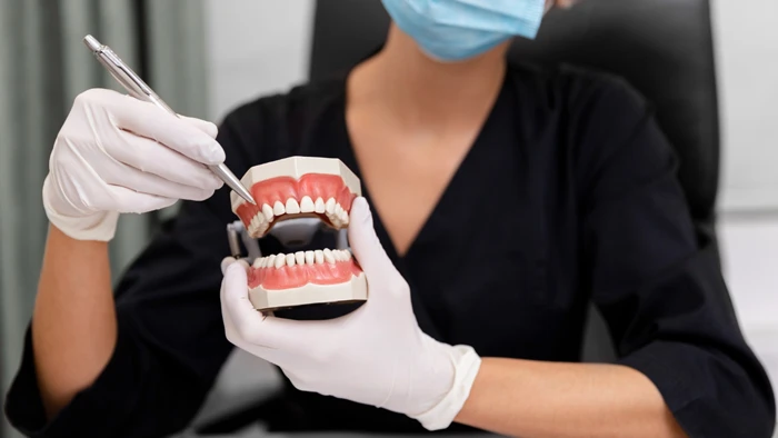 ایمپلنت دندان