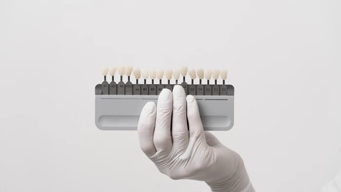 ایمپلنت دندان