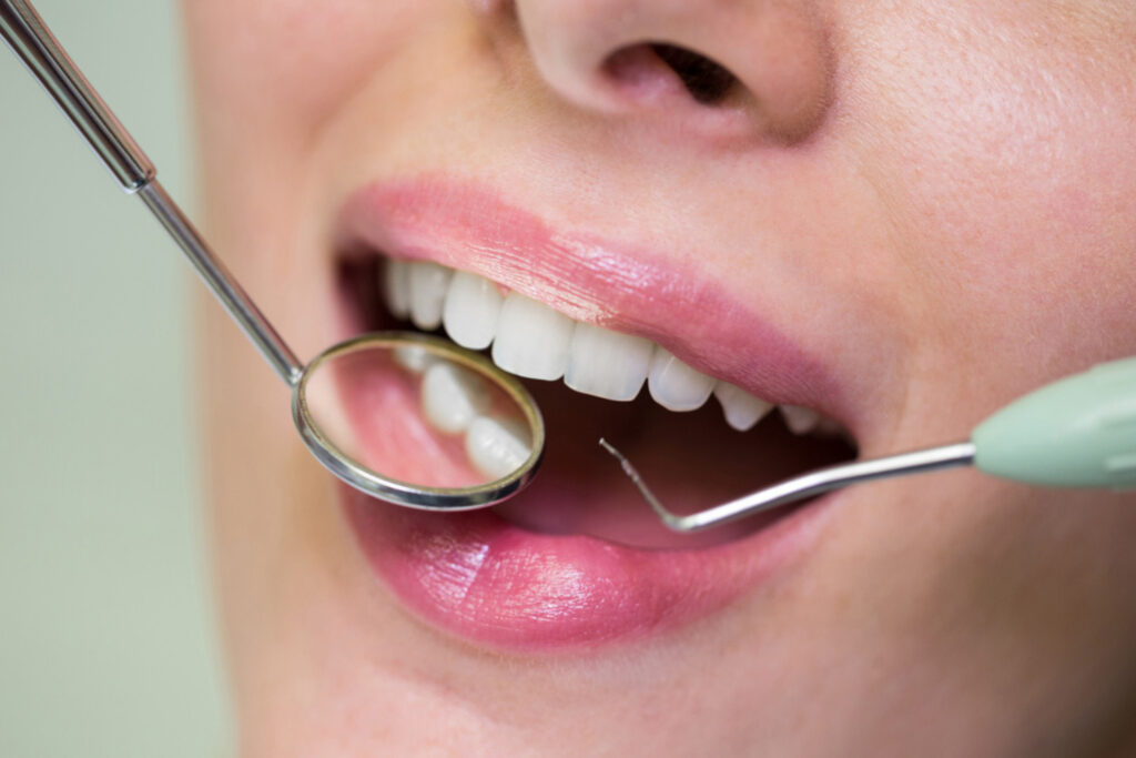 چکاپ سلامت دندان