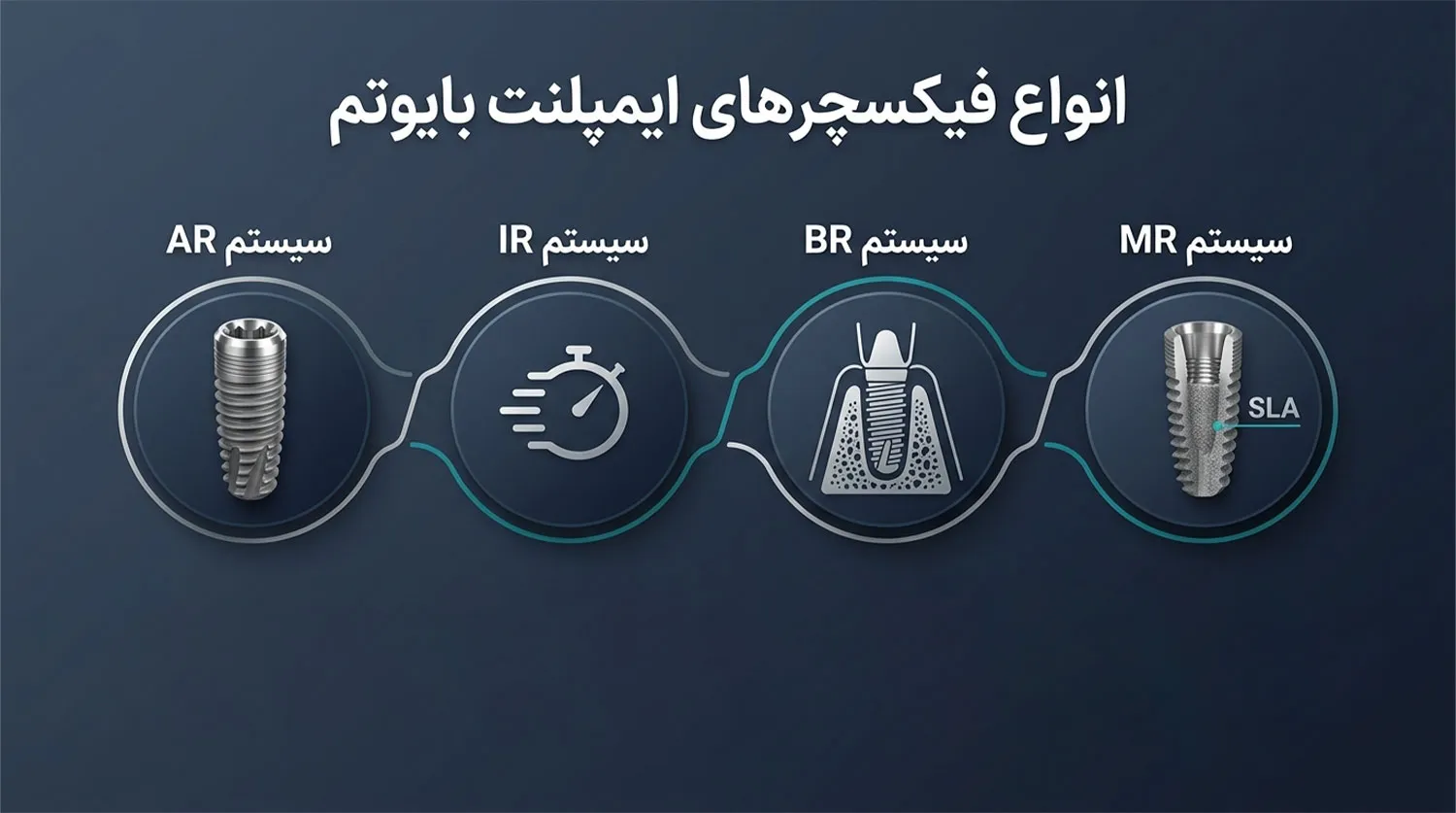 انواع فیکسچر ایمپلنت بایوتم biotem implant fixture types