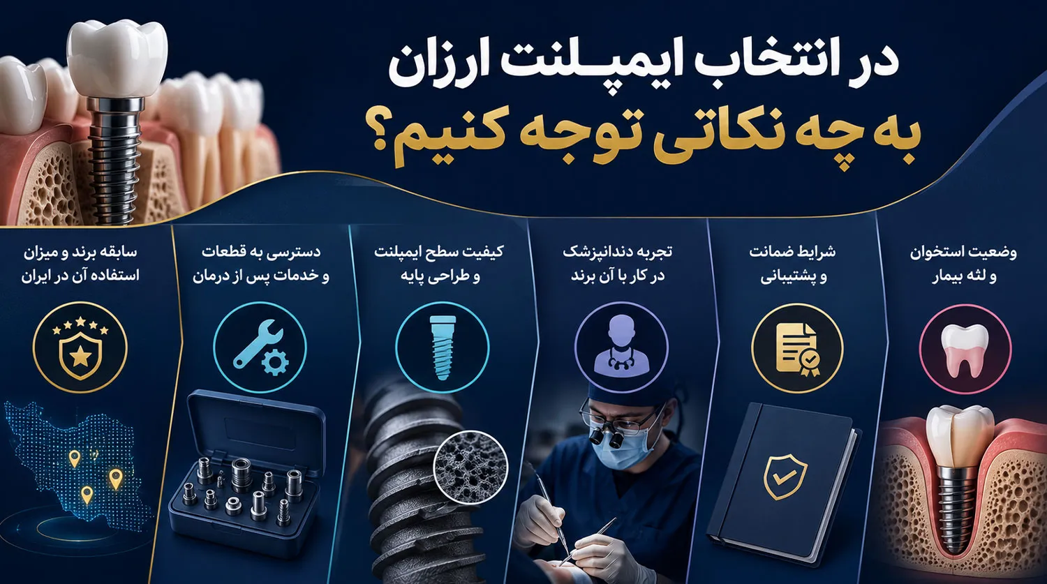 قیمت ایمپلنت ارزان