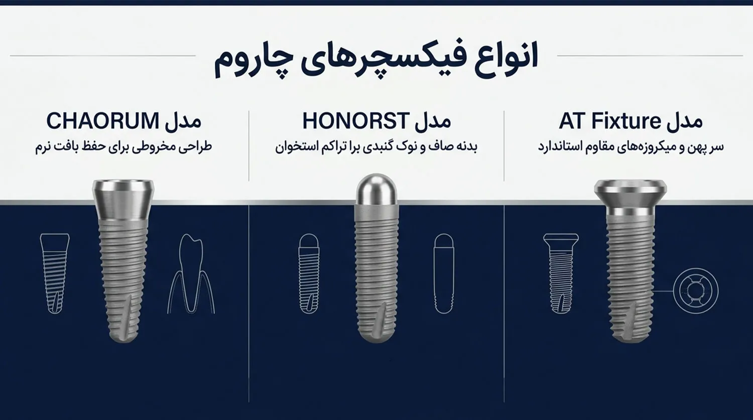 انواع فیکسچرهای ایمپلنت چاروم charum implant fixture types