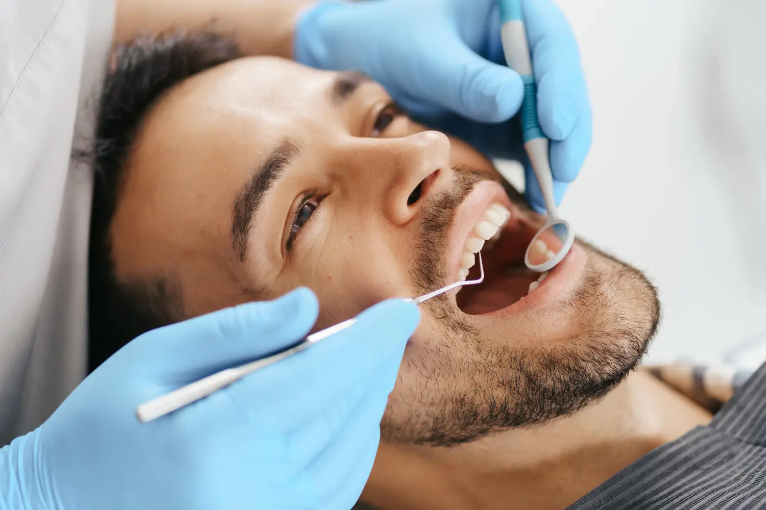 قیمت عصب‌کشی دندان cost endo