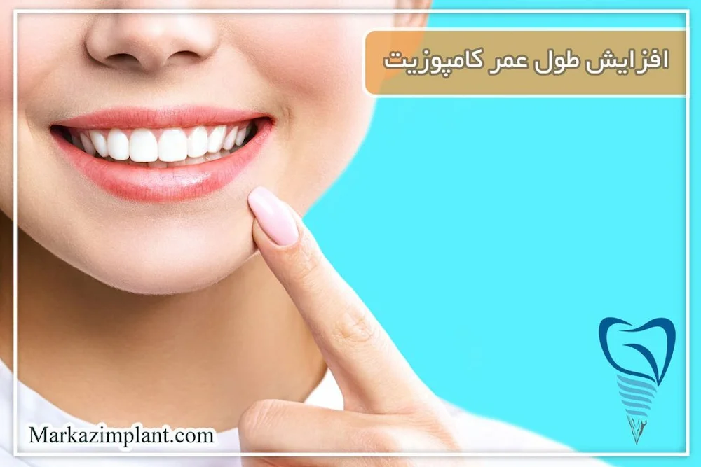 طول عمر کامپوزیت دندان dental composite lifetime