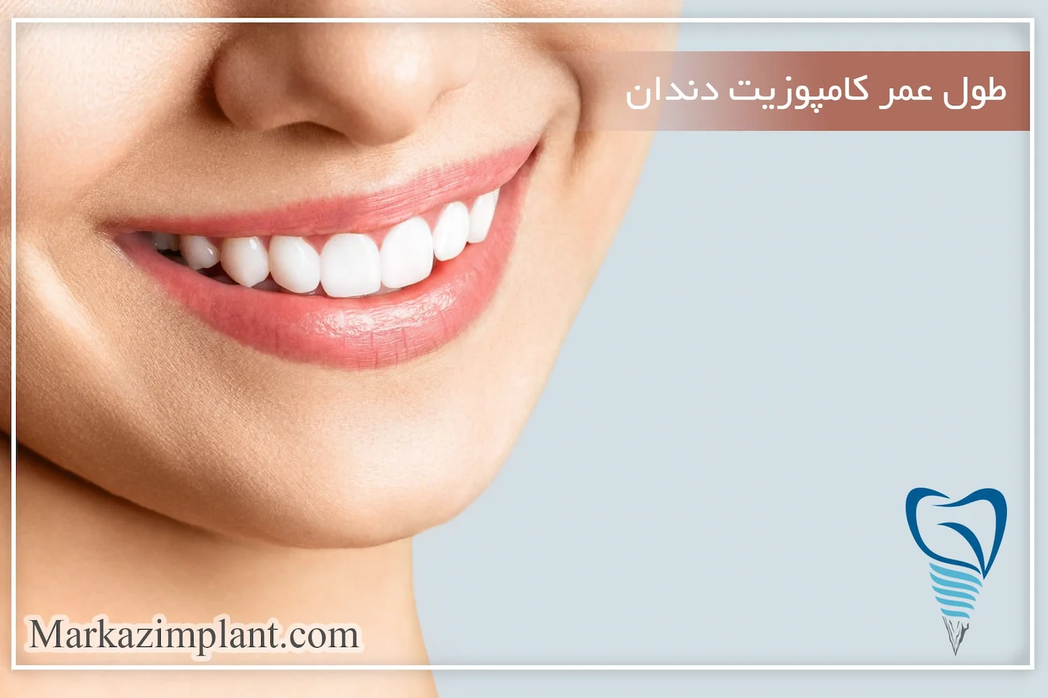 طول عمر کامپوزیت دندان dental composite lifetime