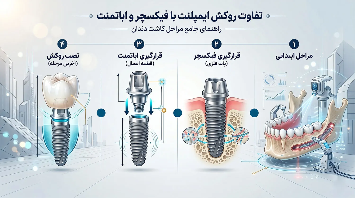 تفاوت روکش با فیکسچر و اباتمنت ایمپلنت