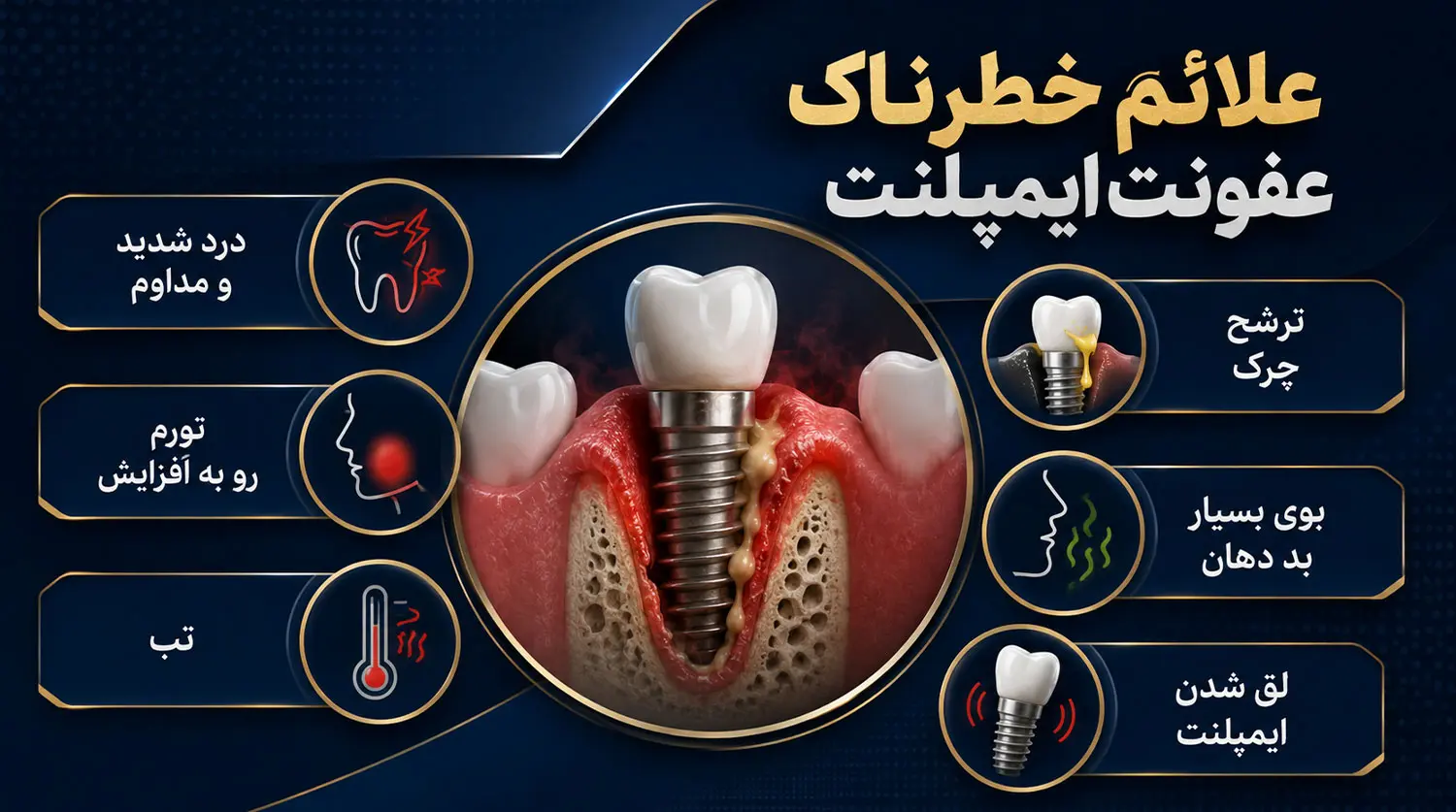 علائم عفونت ایمپلنت دندان