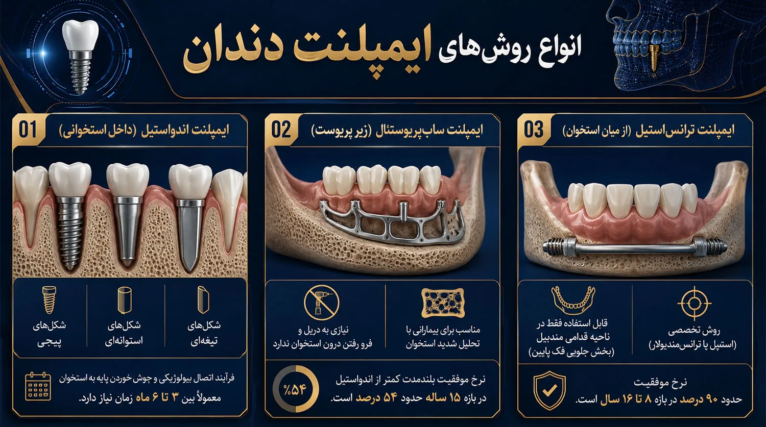 انواع روش های ایمپلنت دندان