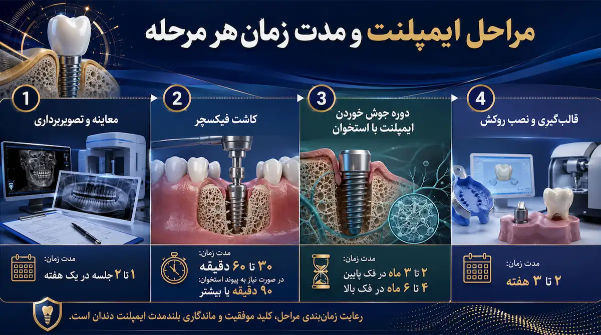 مدت زمان هر مرحله ایمپلنت دندان dental implant procedure steps