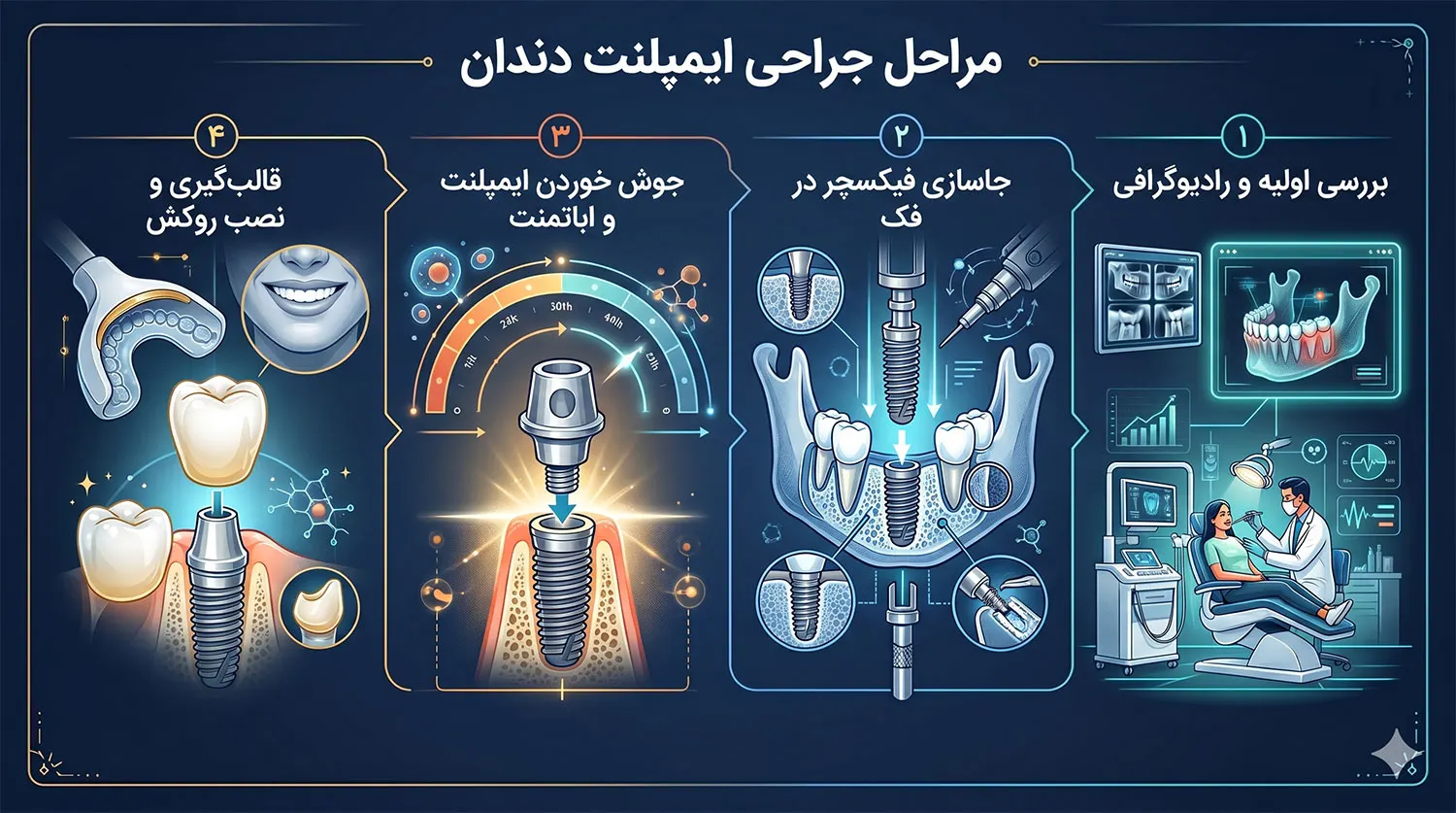 مراحل جراحی ایمپلنت دندان