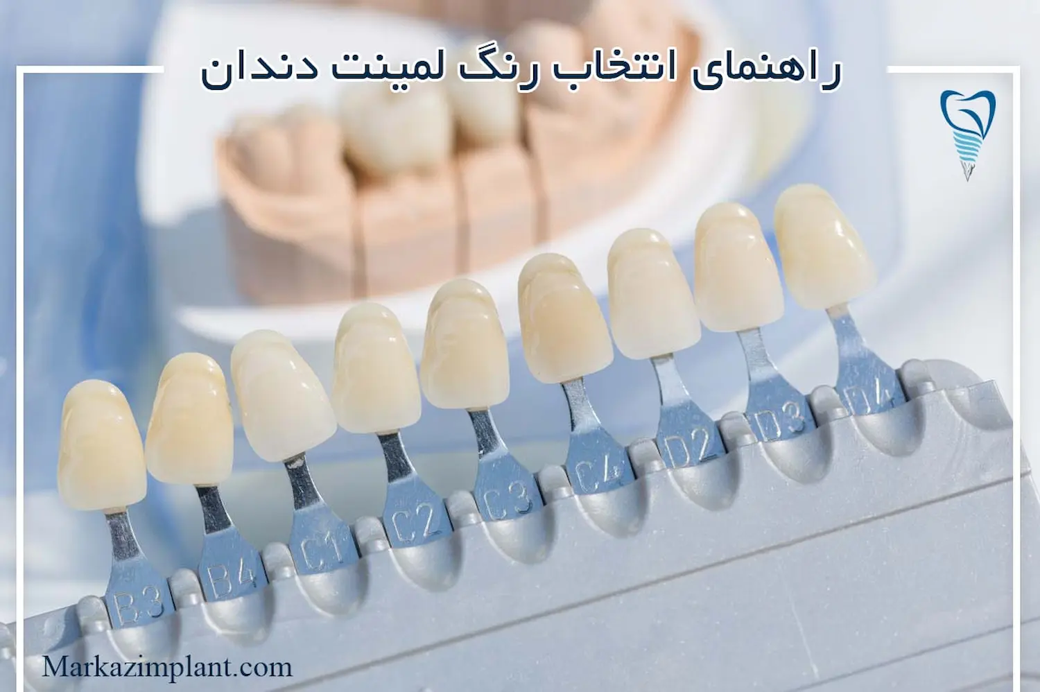 انتخاب رنگ لمینت دندان dental laminate color