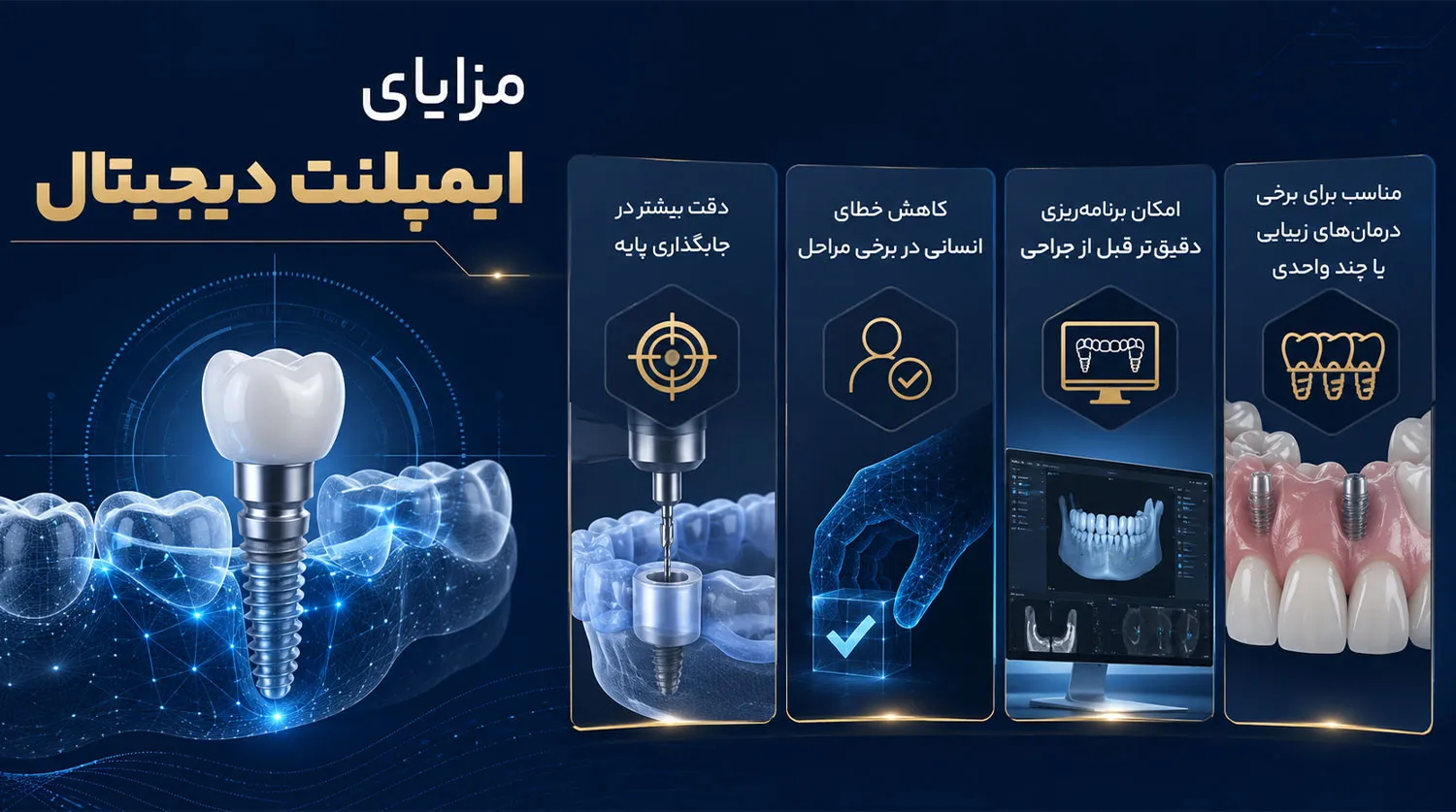 قیمت ایمپلنت دیجیتال