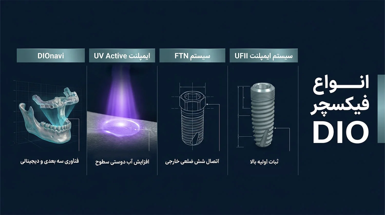 انواع فیکسچر ایمپلنت دیو dio implant fixture types