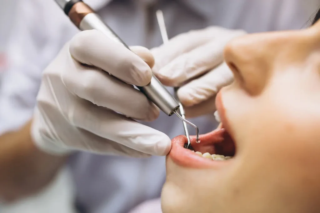 عصب‌کشی دندان endo