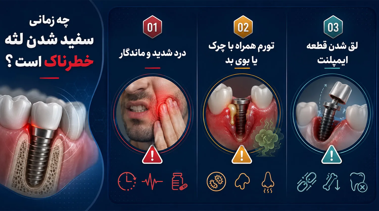خطرناک بودن التهاب و سفیدی لثه بعد از ایمپلنت gum whitening dangerous when