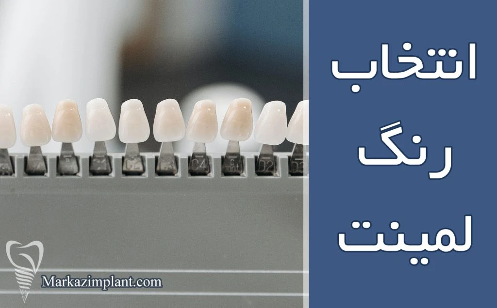 انتخاب رنگ لمینت