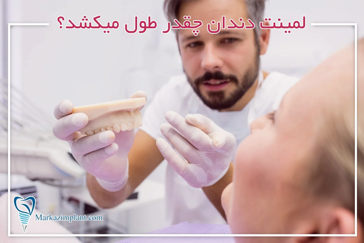 لمینت دندان چقدر طول میکشد how long dental veneer