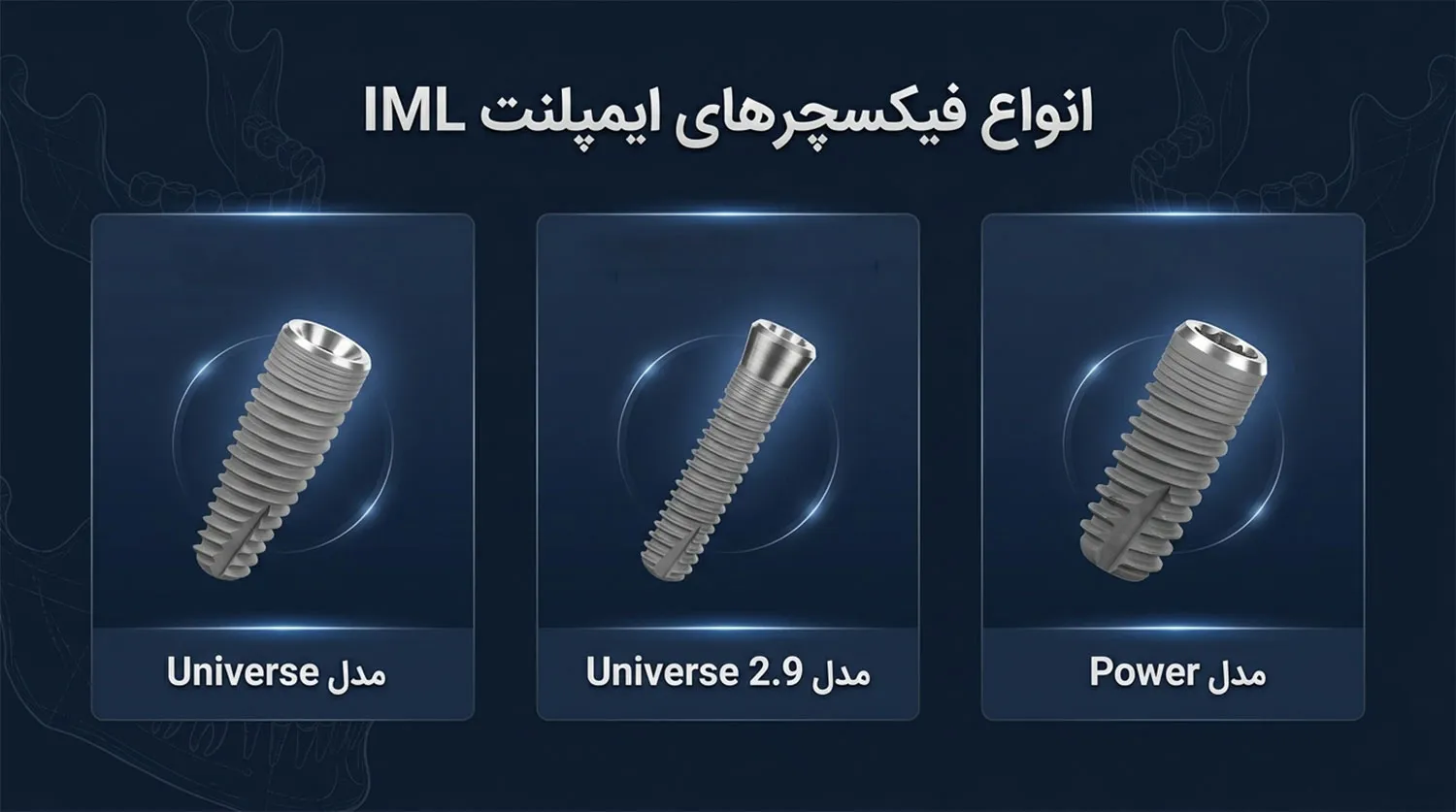 انواع فیکسچر ایمپلنت ای ام ال