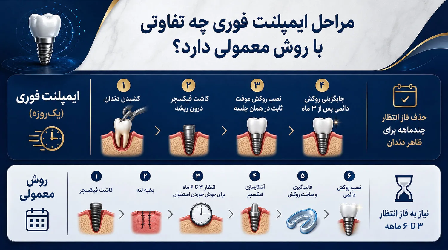 فرق مراحل ایمپلنت فوری و معمولی immediate vs conventional implant steps