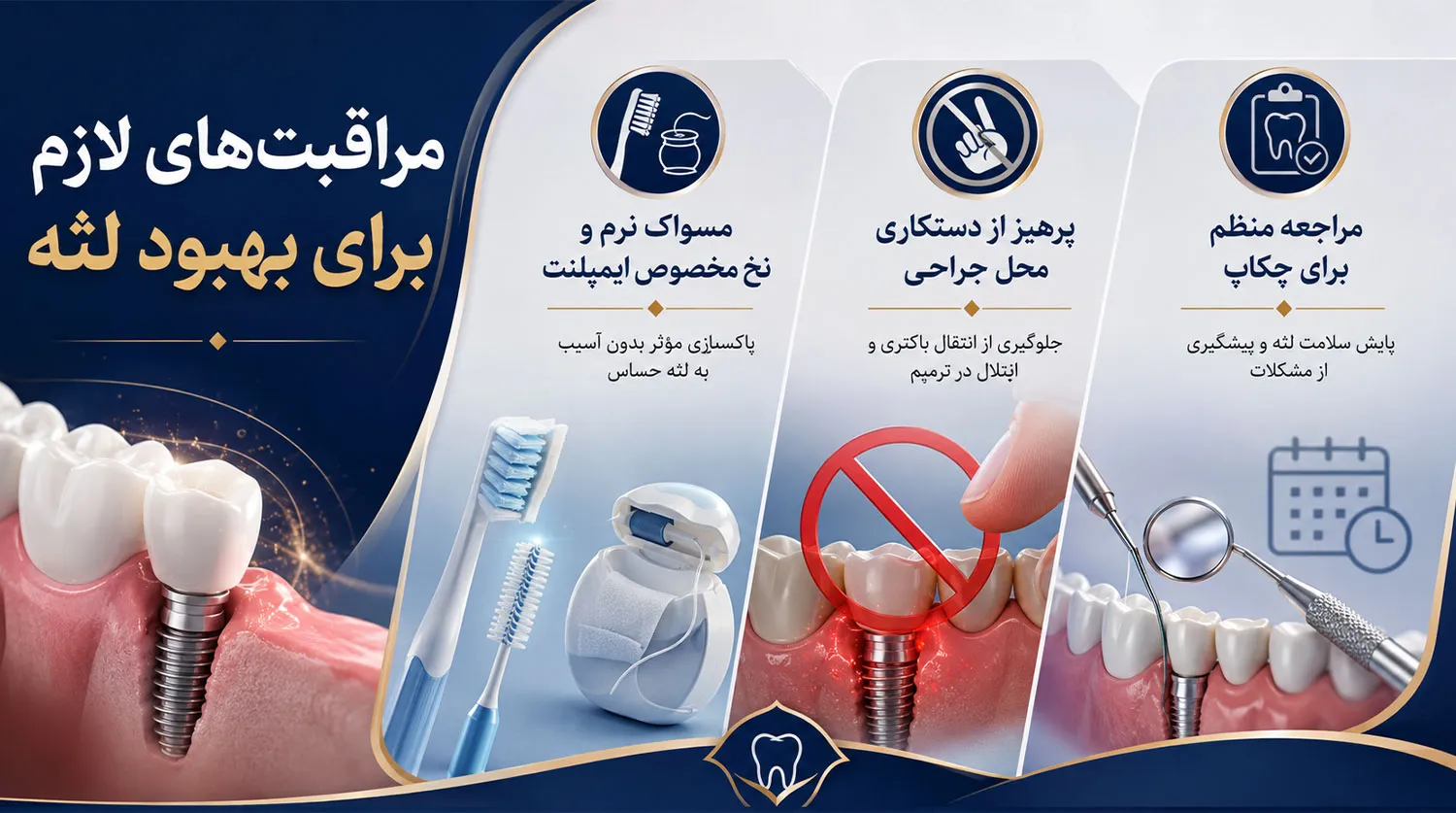مراقبت های لازم برای بهبود التهاب و سفیدی لثه بعد از ایمپلنت implant gum care