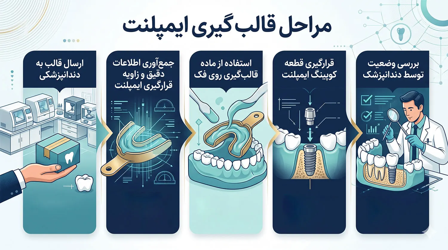 مراحل قالب گیری ایمپلنت