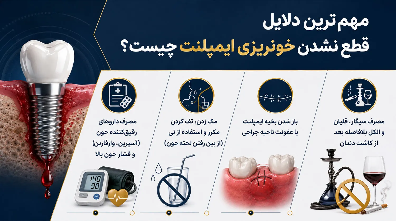 مهمترین دلایل قطع نشدن خونریزی ایمپلنت دندان