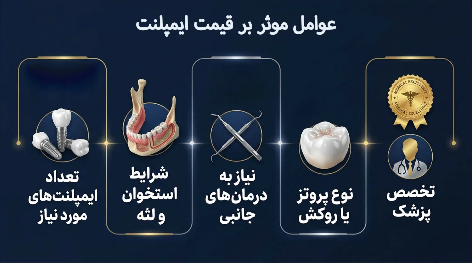 عوامل موثر بر قیمت ایمپلنت روت