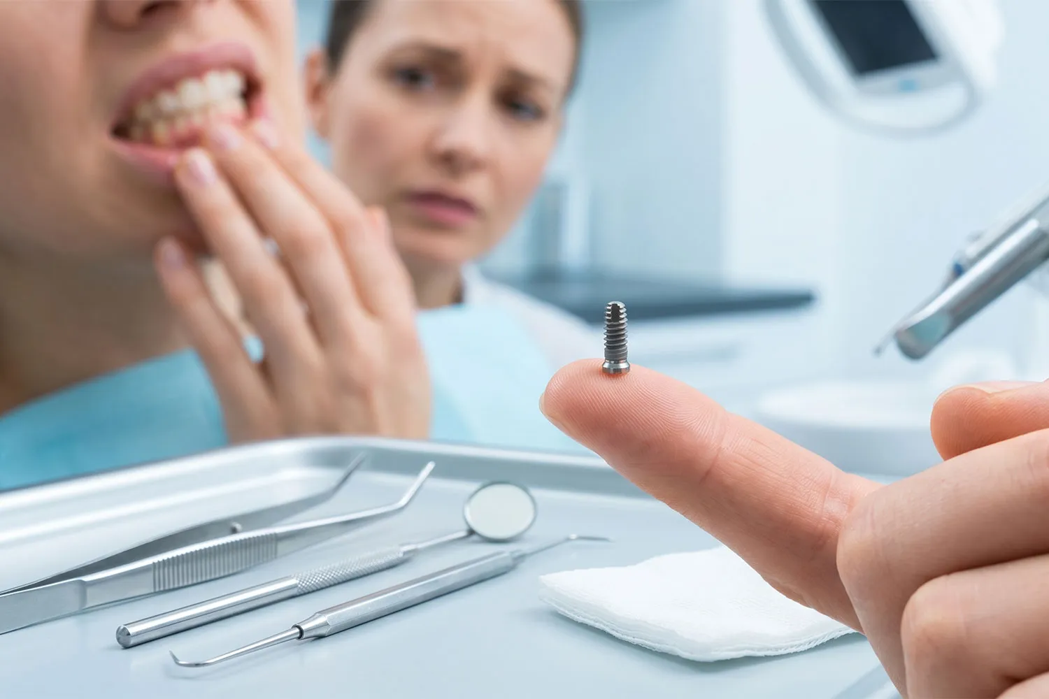 راهنمای افتادن پیچ ایمپلنت implant screw loosening guide