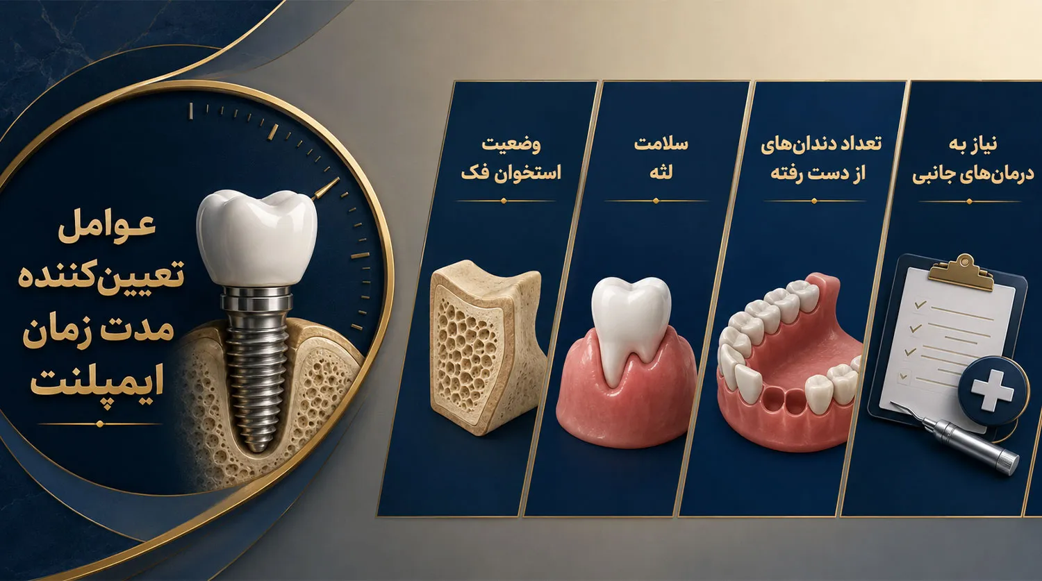 عوامل موثر در مدت زمان کاشت ایمپلنت implant treatment time factors