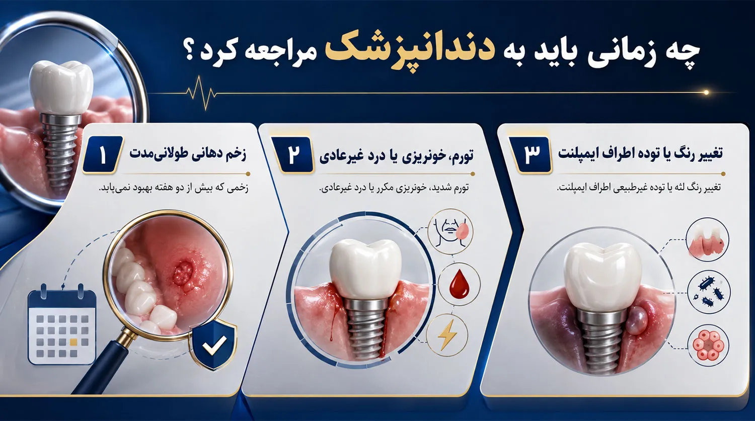 زمان مراجعه به دندانپزشک بعد از ایمپلنت implant unusual symptoms