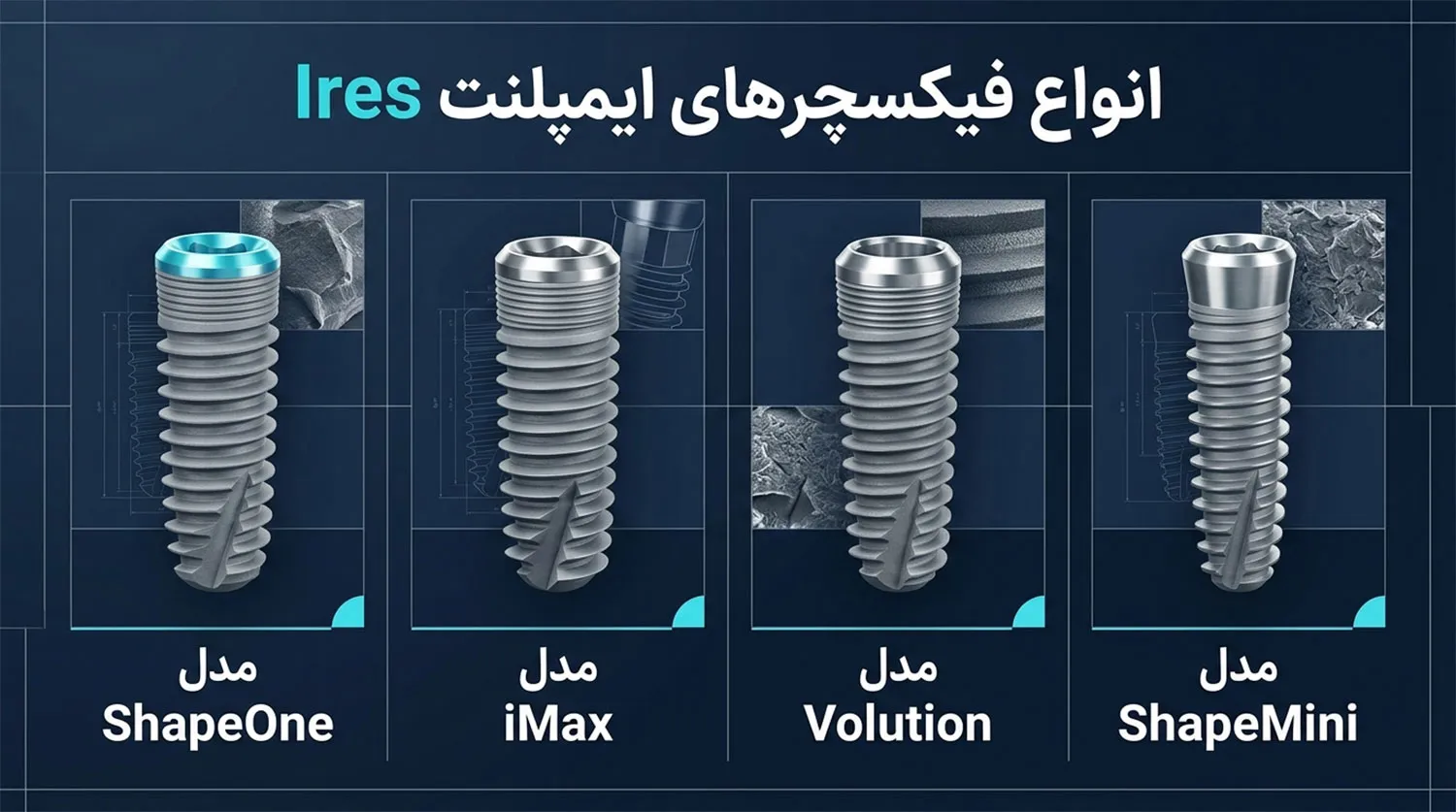 انواع فیکسچر ایمپلنت آیرس ires implant fixture types 