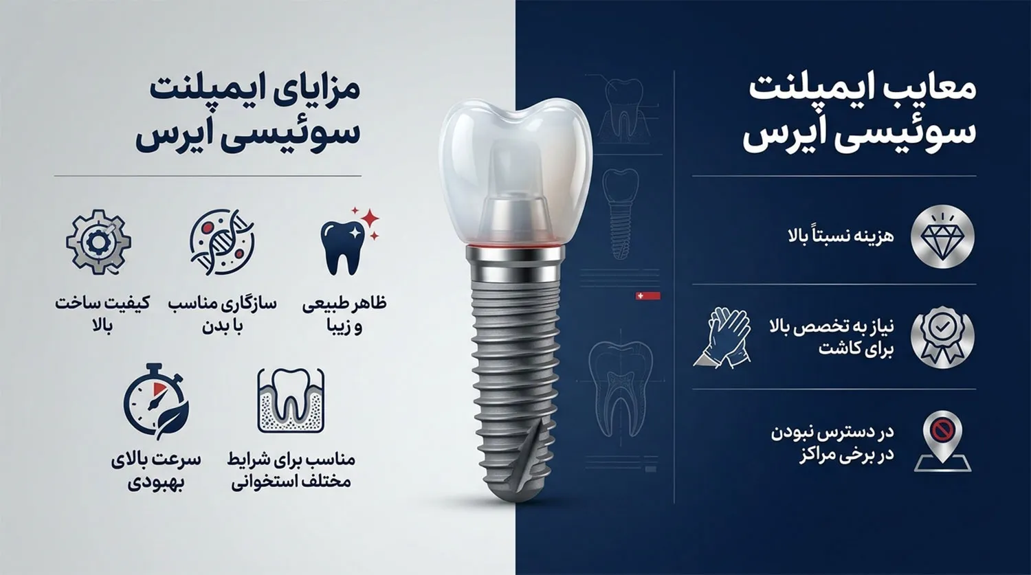مزایا و معایب ایمپلنت آیرس ires implant pros cons