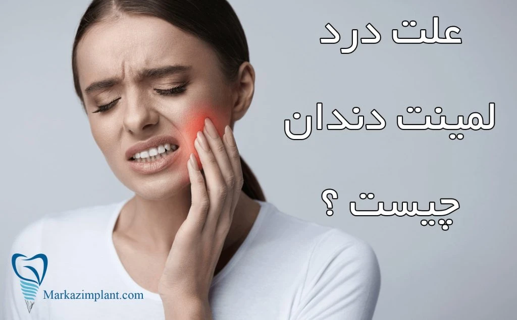 علت درد لمینت دندان