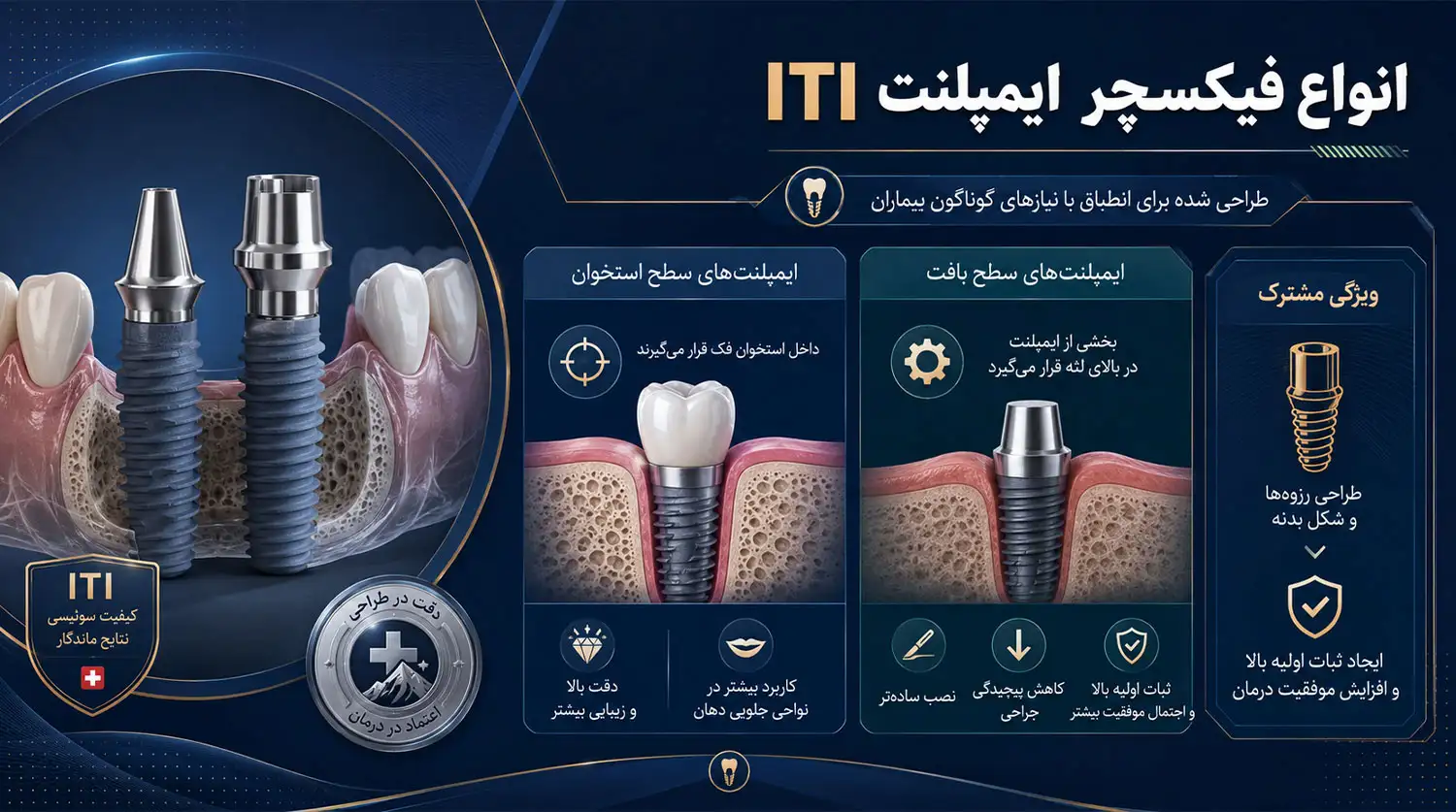 انواع فیکسچرهای ایمپلنت ای تی ای iti implant fixture types