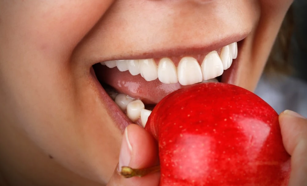 مراقبت از لمینت دندان