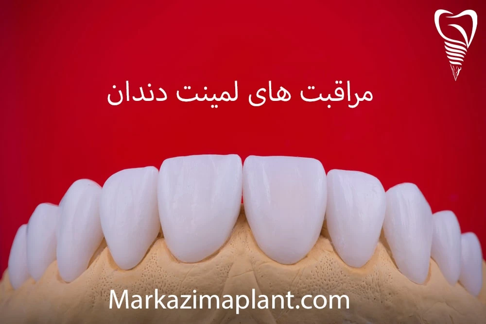 مراقبت بعد از لمینت laminate care
