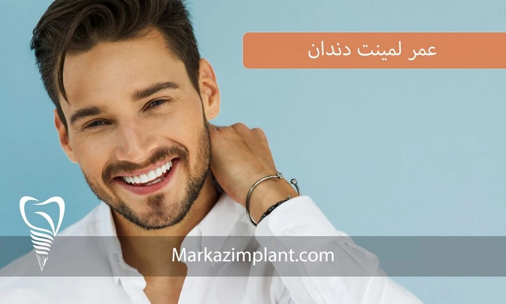 عمر لمینت دندان