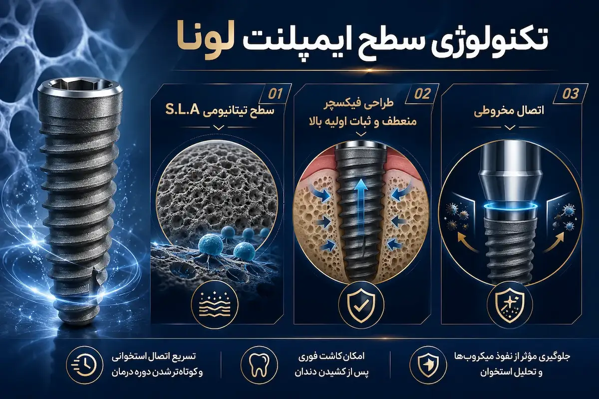 تکنولوژی سطح ایمپلنت کره ای لونا luna implant surface technology