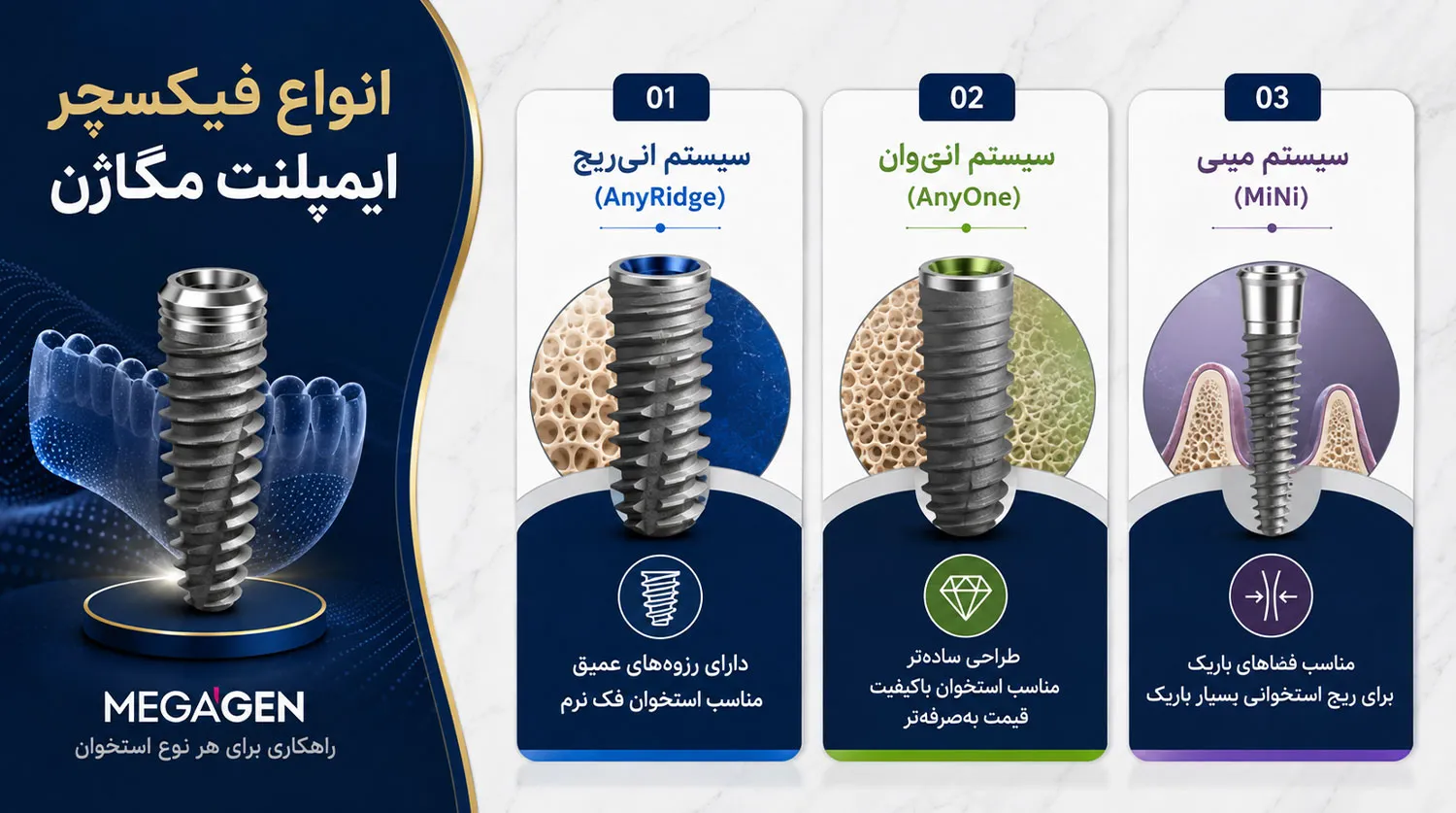 انواع فیکسچر ایمپلنت مگاژن megagen implant fixture types