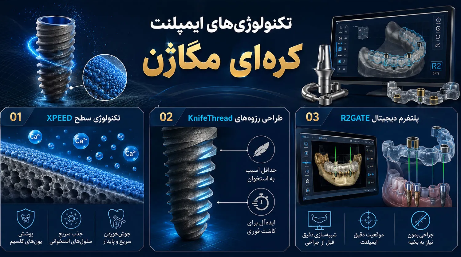 تکنولوژی های ایمپلنت مگاژن megagen implant technologies