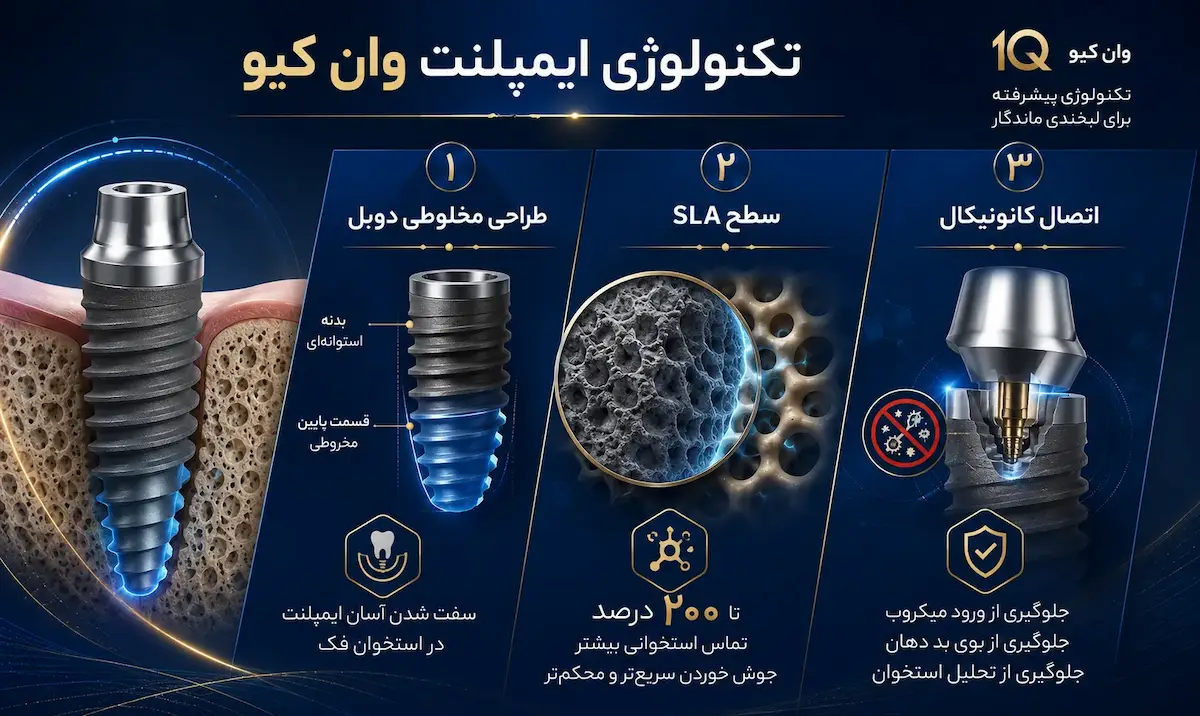 تکنولوژی ایمپلنت وان کیو oneq implant technology