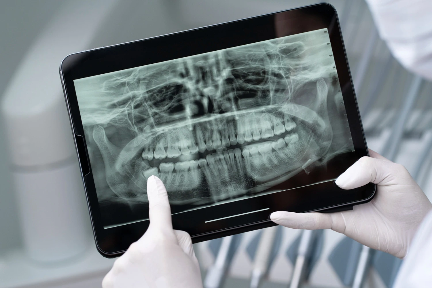رادیولوژی دندان dental opg