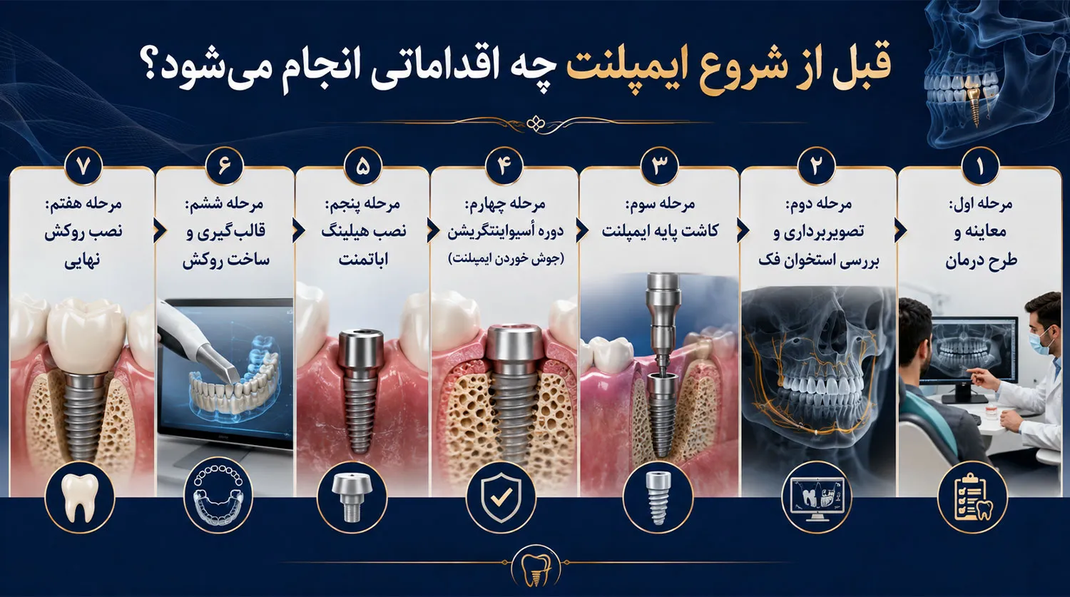 اقدامت قبل از مراحل ایمپلنت دندان pre dental implant procedures